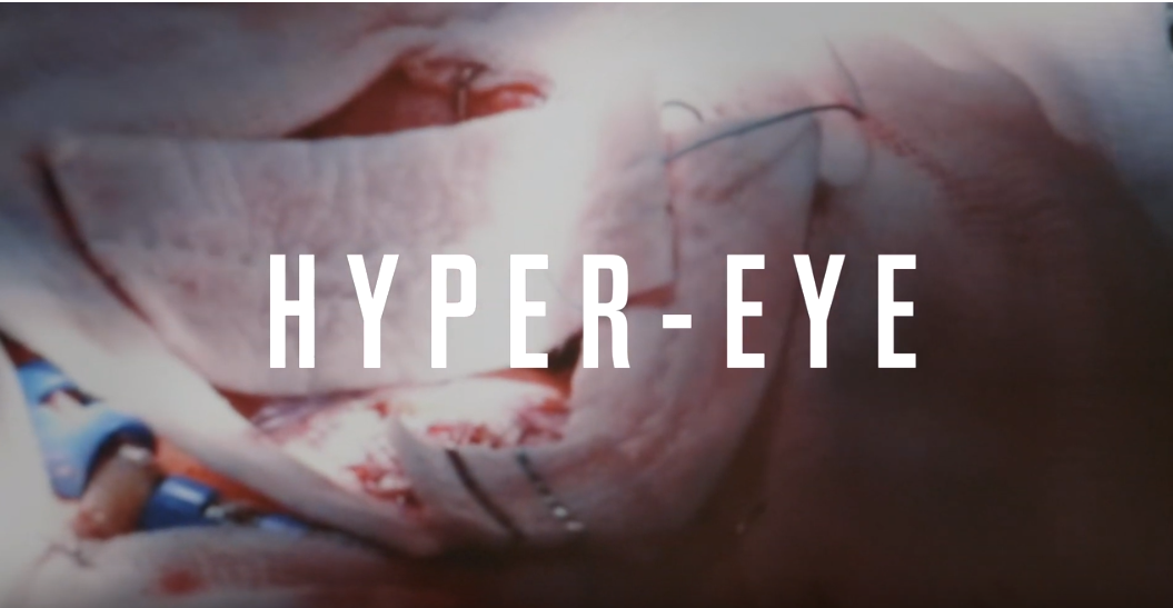 HYPER-EYE